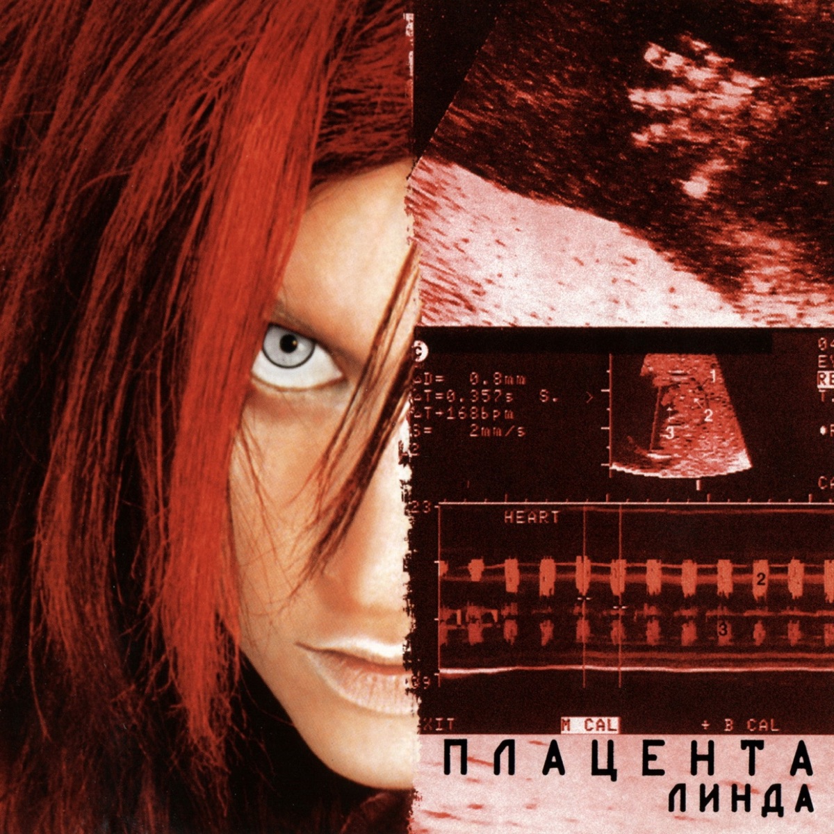Cover Линда - Я не могу