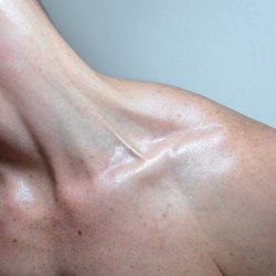 Slipping (Mixed)